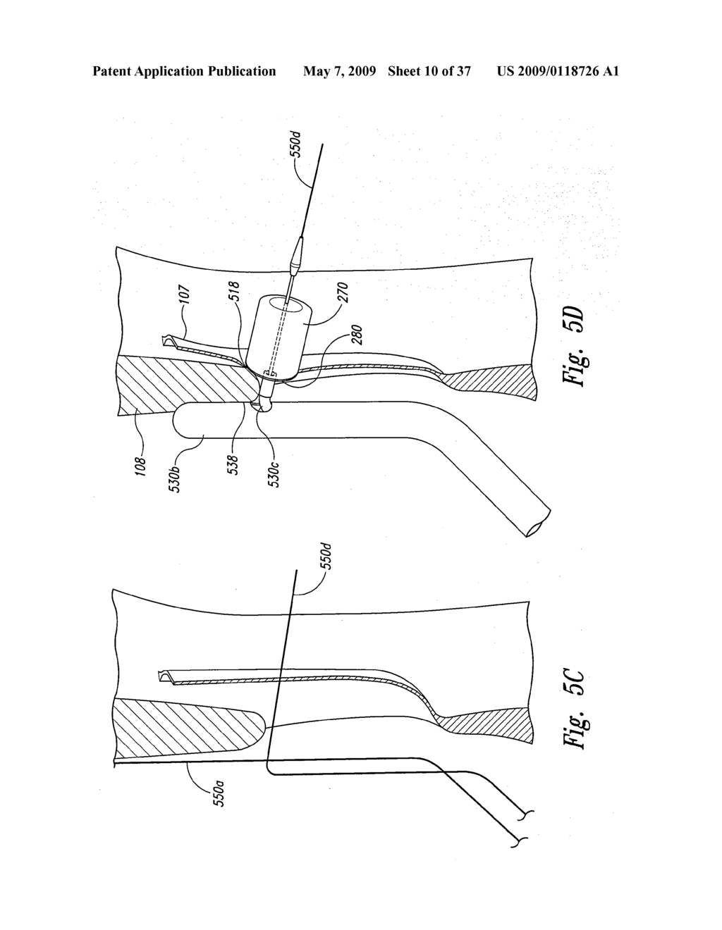 Systems and Methods for Transeptal Cardiac Procedures, Including Tissue Sealing Members Associated Methods - diagram, schematic, and image 11