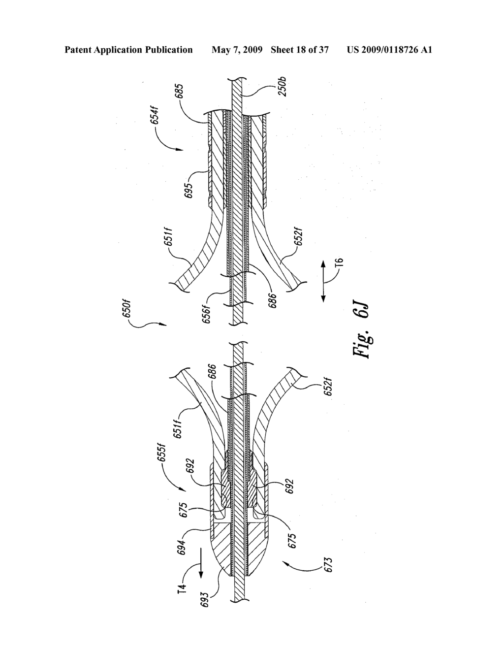 Systems and Methods for Transeptal Cardiac Procedures, Including Tissue Sealing Members Associated Methods - diagram, schematic, and image 19