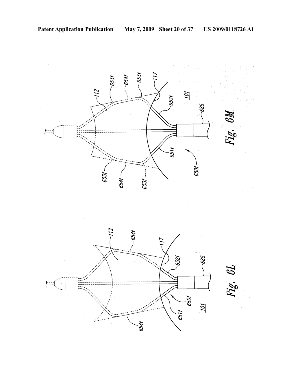 Systems and Methods for Transeptal Cardiac Procedures, Including Tissue Sealing Members Associated Methods - diagram, schematic, and image 21