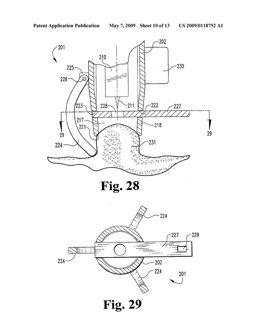 DEVICES AND METHODS FOR EXPRESSION OF BODILY FLUIDS FROM AN INCISION - diagram, schematic, and image 11