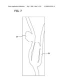 ANEURYSM OCCLUSION DEVICE CONTAINING BIOACTIVE AND BIOCOMPATIBLE COPOLYMER SHELL AND A LIQUID EMBOLIC AGENT diagram and image