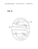 ANEURYSM OCCLUSION DEVICE CONTAINING BIOACTIVE AND BIOCOMPATIBLE COPOLYMER SHELL AND A LIQUID EMBOLIC AGENT diagram and image