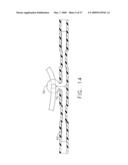 Disposable cartridge for use in a gastric volume reduction procedure diagram and image