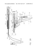 Disposable cartridge for use in a gastric volume reduction procedure diagram and image