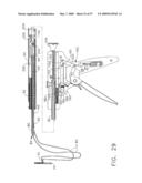 Disposable cartridge for use in a gastric volume reduction procedure diagram and image