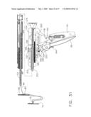 Disposable cartridge for use in a gastric volume reduction procedure diagram and image