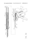 Disposable cartridge for use in a gastric volume reduction procedure diagram and image