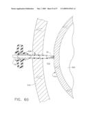 Disposable cartridge for use in a gastric volume reduction procedure diagram and image