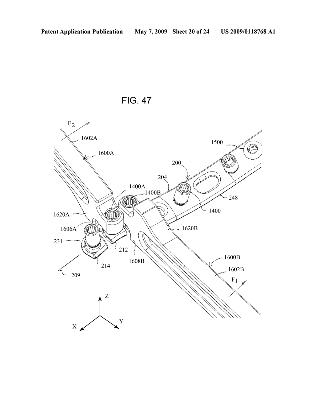 Elbow Fracture Fixation System - diagram, schematic, and image 21