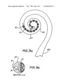 MULTI-ELECTRODE COCHLEAR IMPLANT SYSTEM WITH DISTRIBUTED ELECTRONICS diagram and image