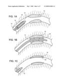 ENDOPROSTHESIS COATING diagram and image