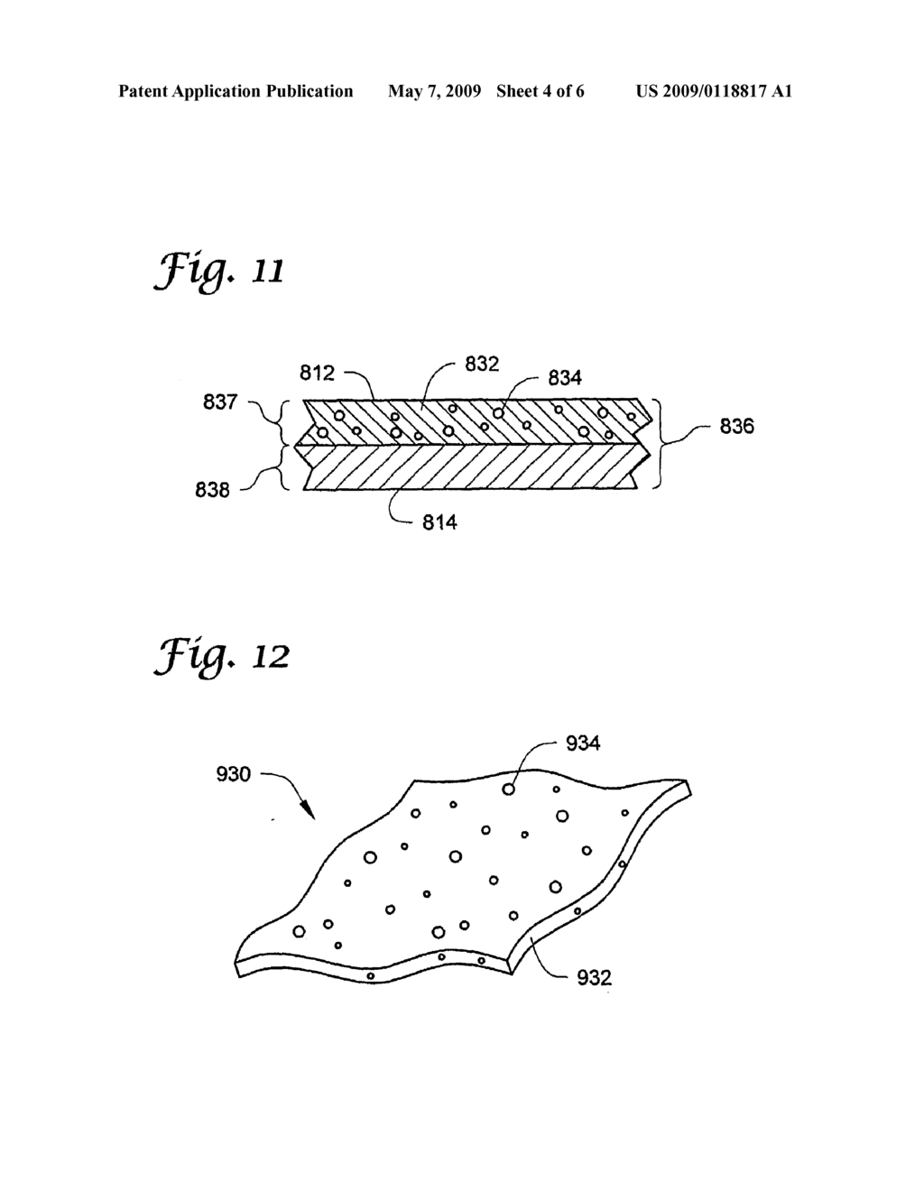 Magnetic Medical Apparatus, Kits, and Methods - diagram, schematic, and image 05