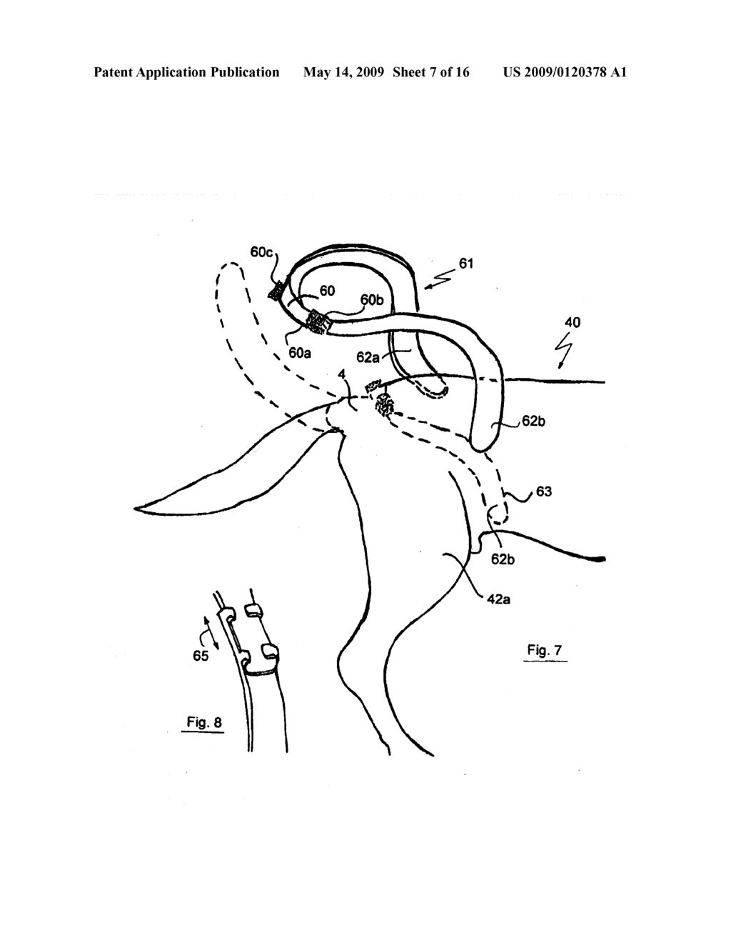 DEVICE AND METHOD FOR CATCHING EXCREMENT - diagram, schematic, and image 08