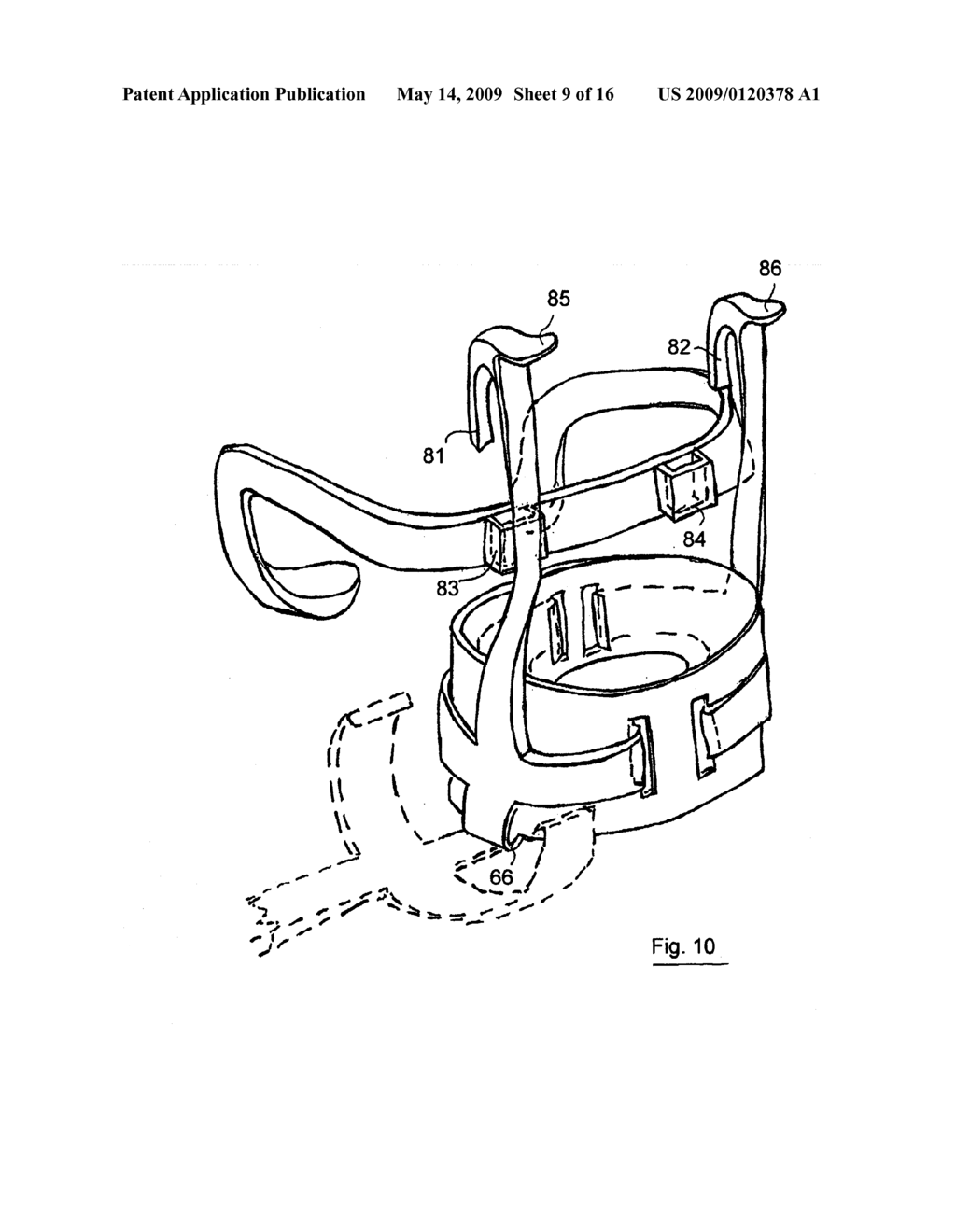 DEVICE AND METHOD FOR CATCHING EXCREMENT - diagram, schematic, and image 10