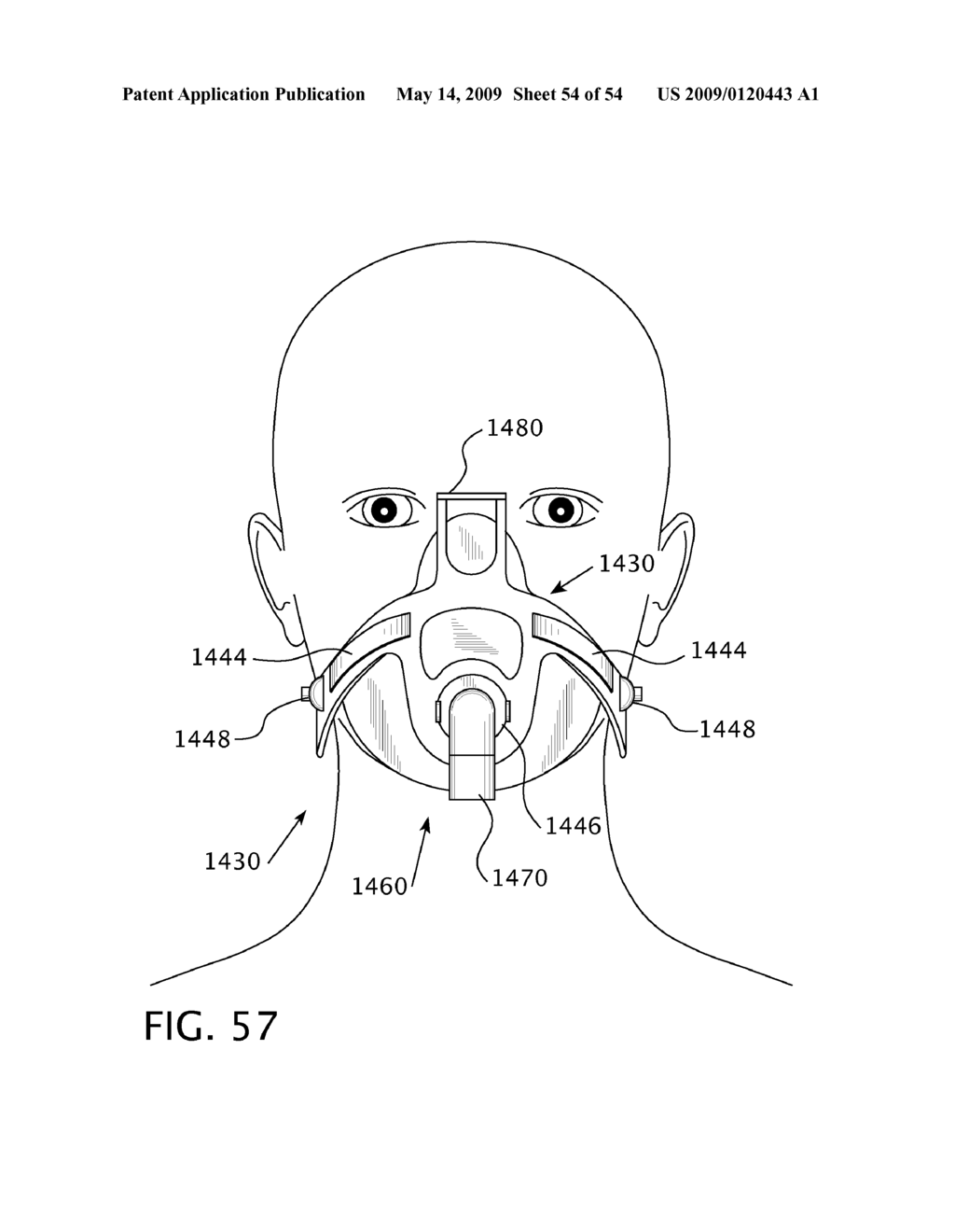 CHIN PIVOT PATIENT INTERFACE DEVICE - diagram, schematic, and image 55