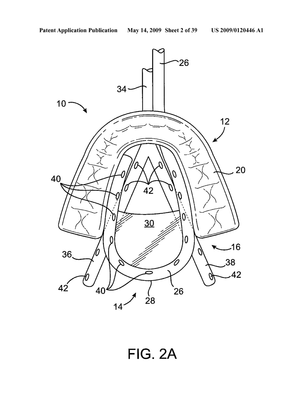 METHODS AND SYSTEMS FOR IMPROVING AIRWAY PATENCY - diagram, schematic, and image 03