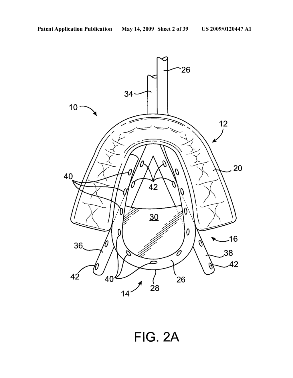 METHODS AND SYSTEMS FOR CREATING PRESSURE GRADIENTS TO IMPROVE AIRWAY PATENCY - diagram, schematic, and image 03