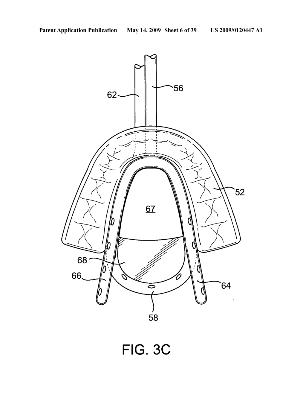 METHODS AND SYSTEMS FOR CREATING PRESSURE GRADIENTS TO IMPROVE AIRWAY PATENCY - diagram, schematic, and image 07