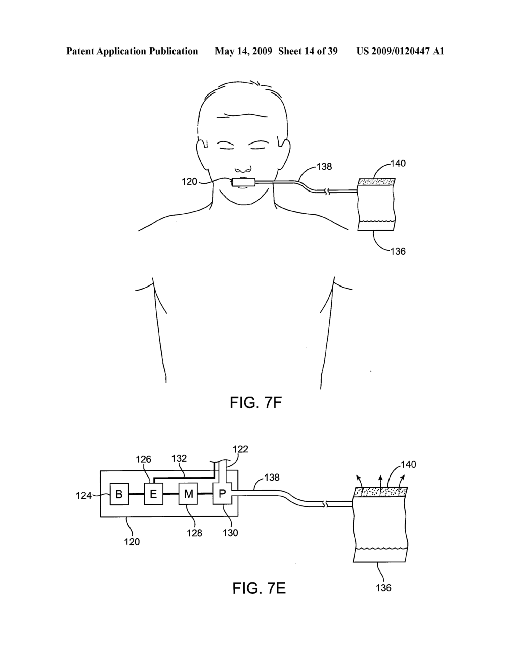 METHODS AND SYSTEMS FOR CREATING PRESSURE GRADIENTS TO IMPROVE AIRWAY PATENCY - diagram, schematic, and image 15