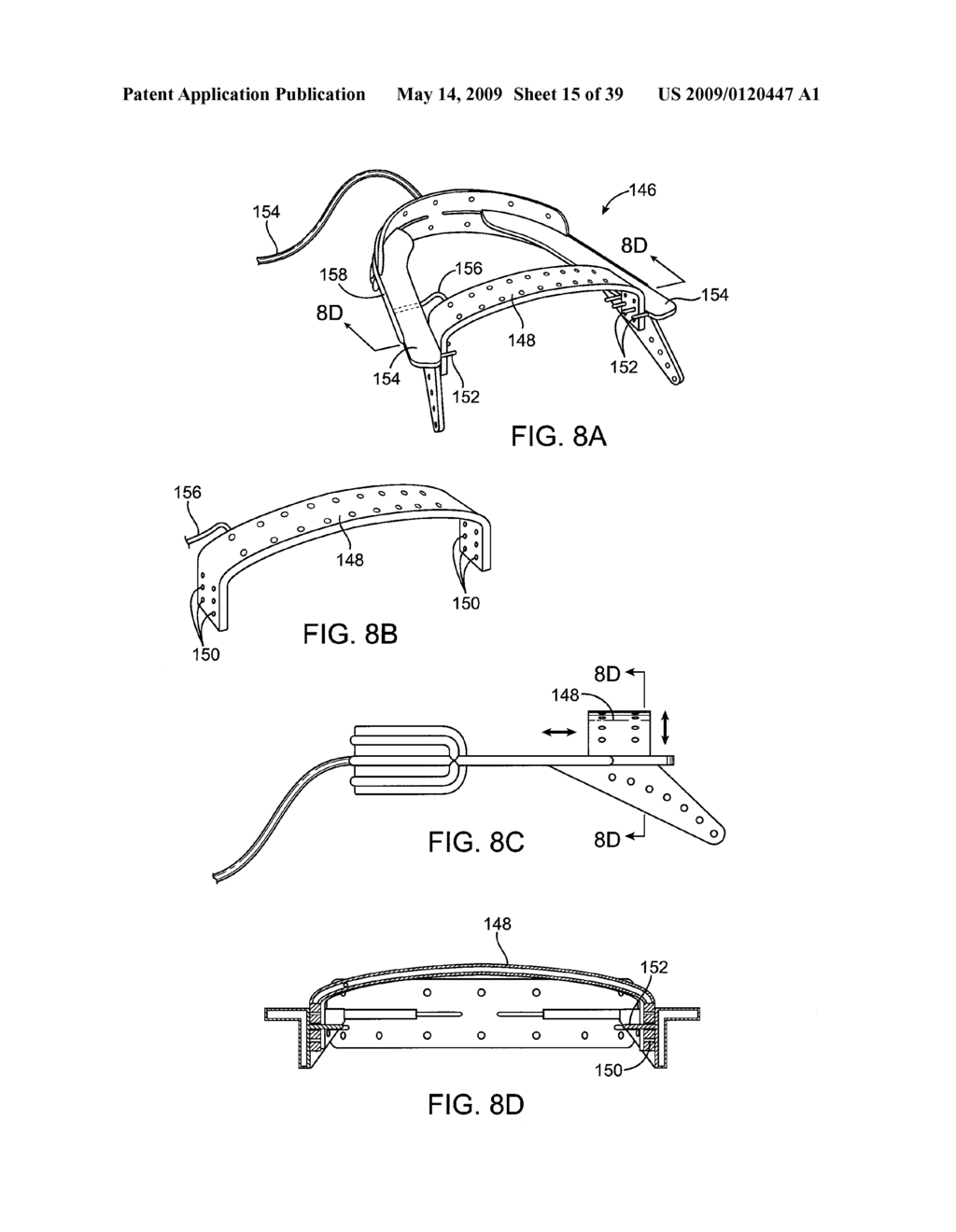 METHODS AND SYSTEMS FOR CREATING PRESSURE GRADIENTS TO IMPROVE AIRWAY PATENCY - diagram, schematic, and image 16