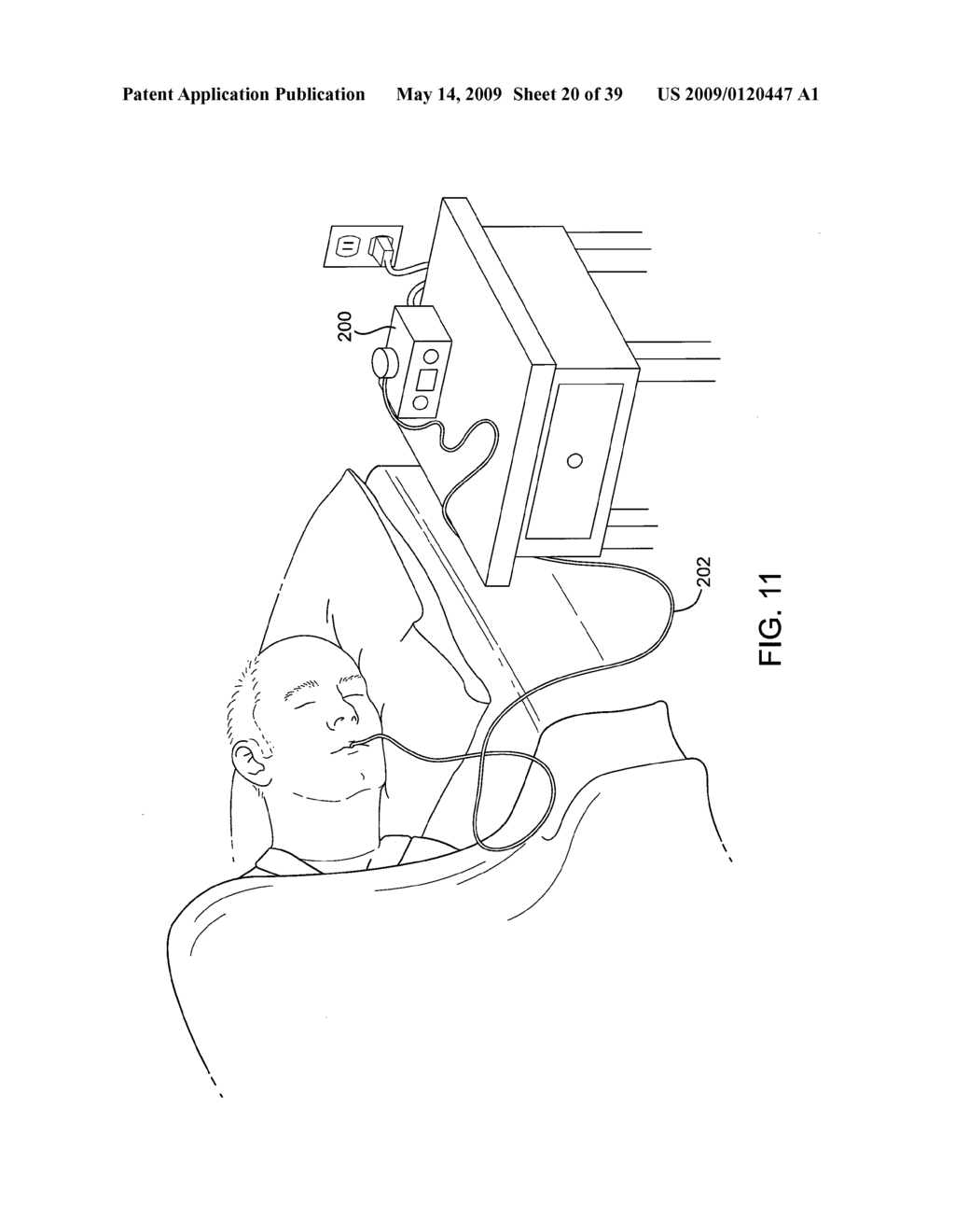 METHODS AND SYSTEMS FOR CREATING PRESSURE GRADIENTS TO IMPROVE AIRWAY PATENCY - diagram, schematic, and image 21