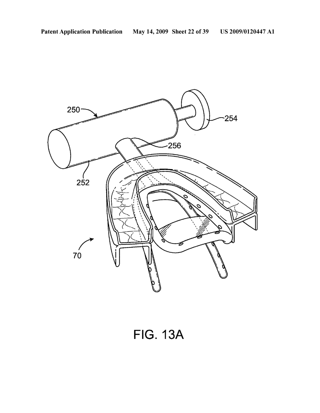 METHODS AND SYSTEMS FOR CREATING PRESSURE GRADIENTS TO IMPROVE AIRWAY PATENCY - diagram, schematic, and image 23