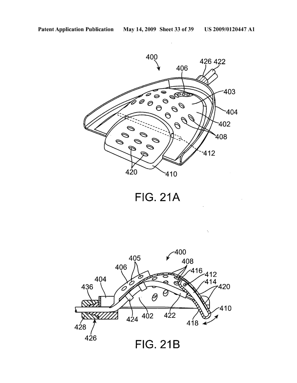 METHODS AND SYSTEMS FOR CREATING PRESSURE GRADIENTS TO IMPROVE AIRWAY PATENCY - diagram, schematic, and image 34