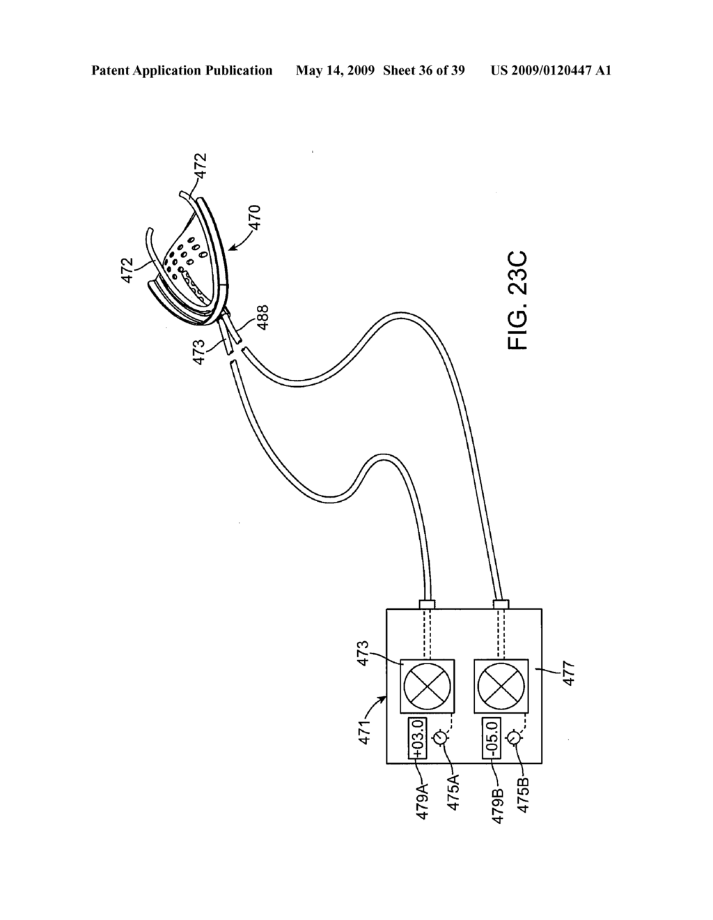 METHODS AND SYSTEMS FOR CREATING PRESSURE GRADIENTS TO IMPROVE AIRWAY PATENCY - diagram, schematic, and image 37