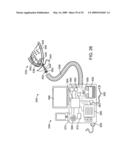 METHODS AND SYSTEMS FOR CREATING PRESSURE GRADIENTS TO IMPROVE AIRWAY PATENCY diagram and image