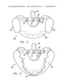 SLEEP APPLIANCE diagram and image