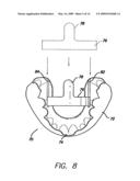 SLEEP APPLIANCE diagram and image