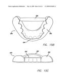 SLEEP APPLIANCE diagram and image