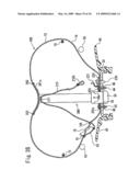 Airbag and Airbag Apparatus diagram and image