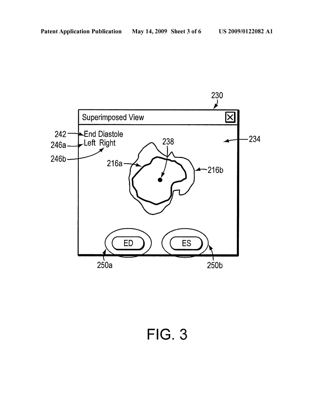 SUPERIMPOSED DISPLAY OF IMAGE CONTOURS - diagram, schematic, and image 04