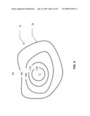 Nodule Detection diagram and image