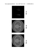 Nodule Detection diagram and image