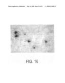 Circovirus sequences associated with piglet weight loss disease (PWD) diagram and image