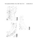 Copper-dependent non-traditional pro-inflammatory cytokine export and methods, compositions and kits relating thereto diagram and image