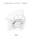 METHODS AND SYSTEMS FOR SALIVA MANAGEMENT WITH AN ORAL DEVICE diagram and image