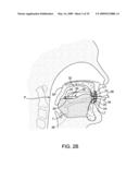 METHODS AND SYSTEMS FOR SALIVA MANAGEMENT WITH AN ORAL DEVICE diagram and image