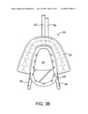 METHODS AND SYSTEMS FOR SALIVA MANAGEMENT WITH AN ORAL DEVICE diagram and image