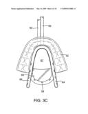 METHODS AND SYSTEMS FOR SALIVA MANAGEMENT WITH AN ORAL DEVICE diagram and image