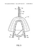 METHODS AND SYSTEMS FOR SALIVA MANAGEMENT WITH AN ORAL DEVICE diagram and image