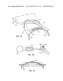 METHODS AND SYSTEMS FOR SALIVA MANAGEMENT WITH AN ORAL DEVICE diagram and image