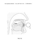 METHODS AND SYSTEMS FOR SALIVA MANAGEMENT WITH AN ORAL DEVICE diagram and image