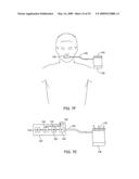 METHODS AND SYSTEMS FOR SALIVA MANAGEMENT WITH AN ORAL DEVICE diagram and image