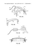 METHODS AND SYSTEMS FOR SALIVA MANAGEMENT WITH AN ORAL DEVICE diagram and image