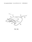 METHODS AND SYSTEMS FOR SALIVA MANAGEMENT WITH AN ORAL DEVICE diagram and image