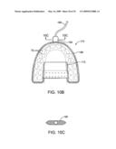 METHODS AND SYSTEMS FOR SALIVA MANAGEMENT WITH AN ORAL DEVICE diagram and image