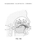 METHODS AND SYSTEMS FOR SALIVA MANAGEMENT WITH AN ORAL DEVICE diagram and image